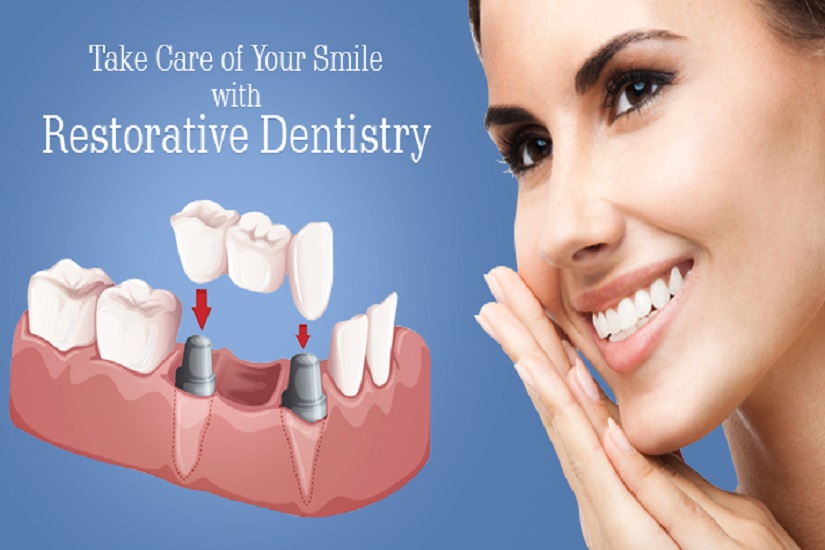 Restorative Dentistry - SmileKonnekt